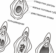 Девственность – быть или не быть?